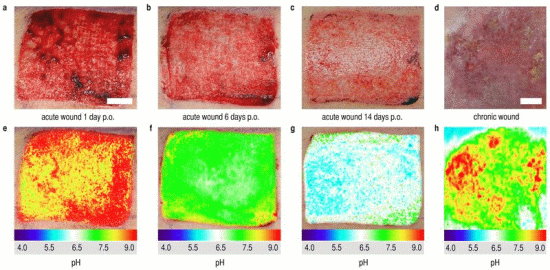 Wunden: Schnappschüsse der Flächenverteilung des pH-Werts