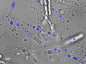 Pythium ultimum