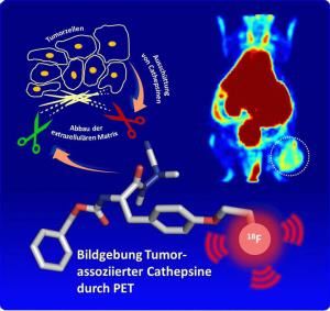 Bildgebung Tumor-assoziierter Cathepsine